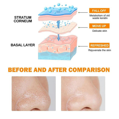 🍊✨[Orange Exfoliating Gel]✨🍊